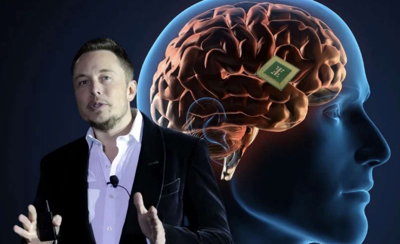 Elon Musk asegura que ya se implantó el primer chip cerebral de