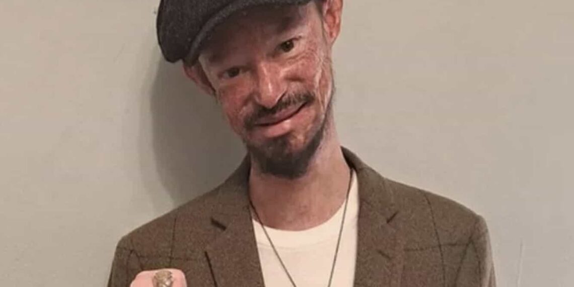 Se desconoce todavía la causa de muerte de Darren Kent pero se sabe que padecía osteoporosis, artritis y una rara enfermedad en la piel.