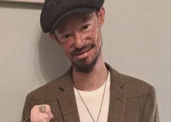 Se desconoce todavía la causa de muerte de Darren Kent pero se sabe que padecía osteoporosis, artritis y una rara enfermedad en la piel.