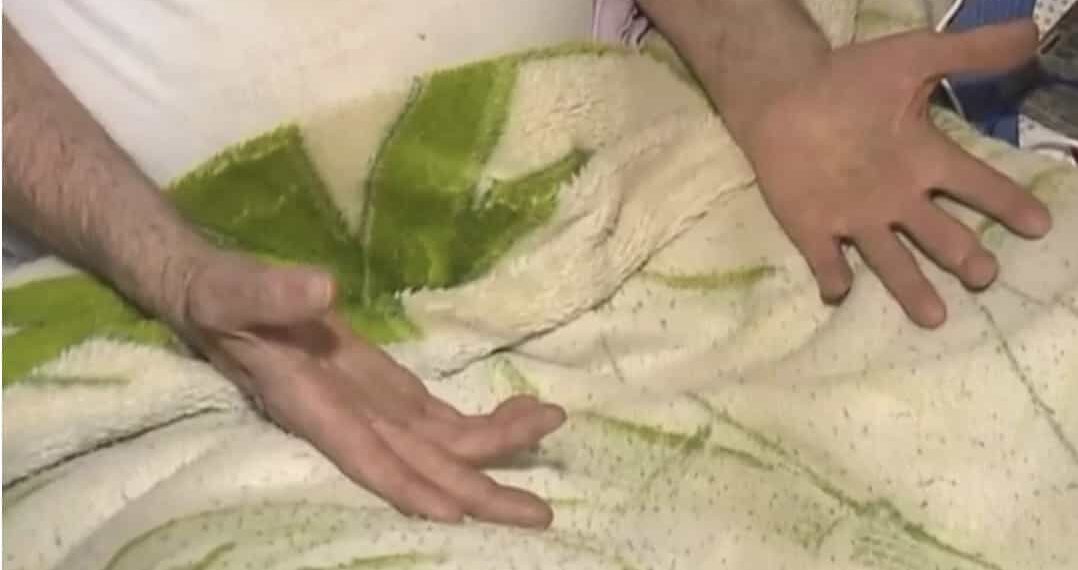 El hombre no puede moverse por sí solo, por lo que actuó rápido y subió a su silla de ruedas para defenderse.