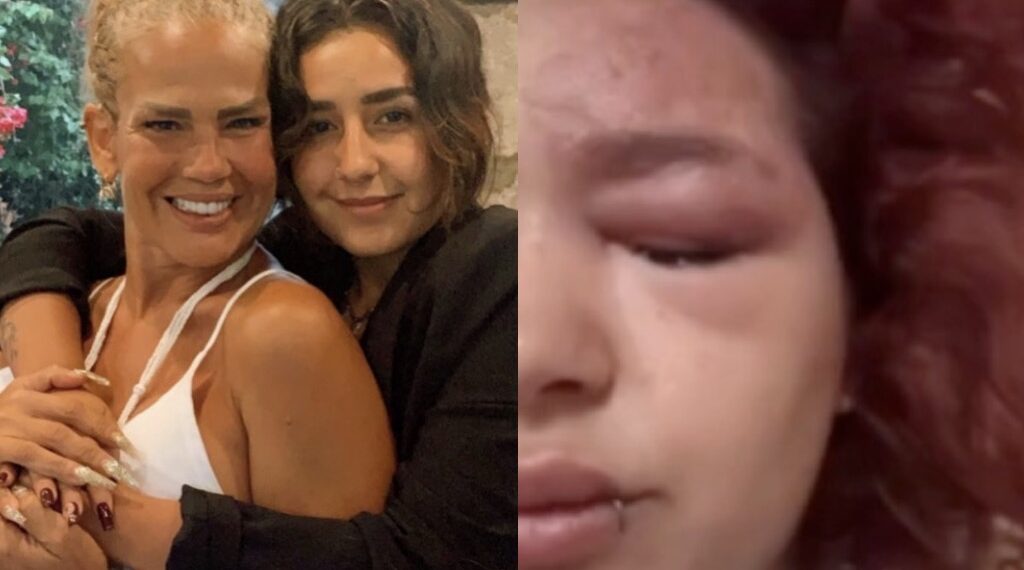 Asimismo, recalcó la importancia de cuidar la salud mental para evitar que el cuerpo manifieste los problemas