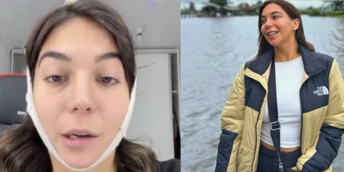 Luciana Milessi ya se había sometido a más de cuatro cirugías estéticas tras recibir críticas sobre su cuerpo en redes, esta era la segunda liposucción de papada que se hacía.