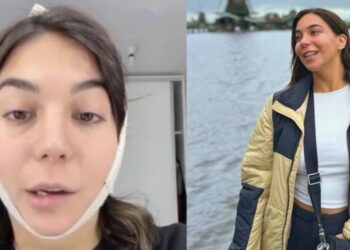 Luciana Milessi ya se había sometido a más de cuatro cirugías estéticas tras recibir críticas sobre su cuerpo en redes, esta era la segunda liposucción de papada que se hacía.