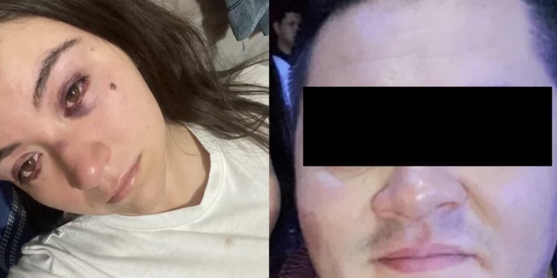 En redes sociales, Grisel hizo pública la agresión que sufrió por parte de su ahora ex pareja.