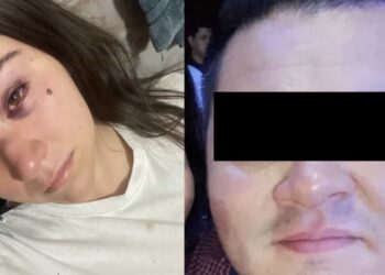 En redes sociales, Grisel hizo pública la agresión que sufrió por parte de su ahora ex pareja.