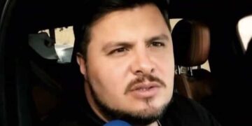 Además, Paul Stanley dijo haberse sometido a un procedimiento estético debido a que aún sigue con algunas de sus inseguridades.