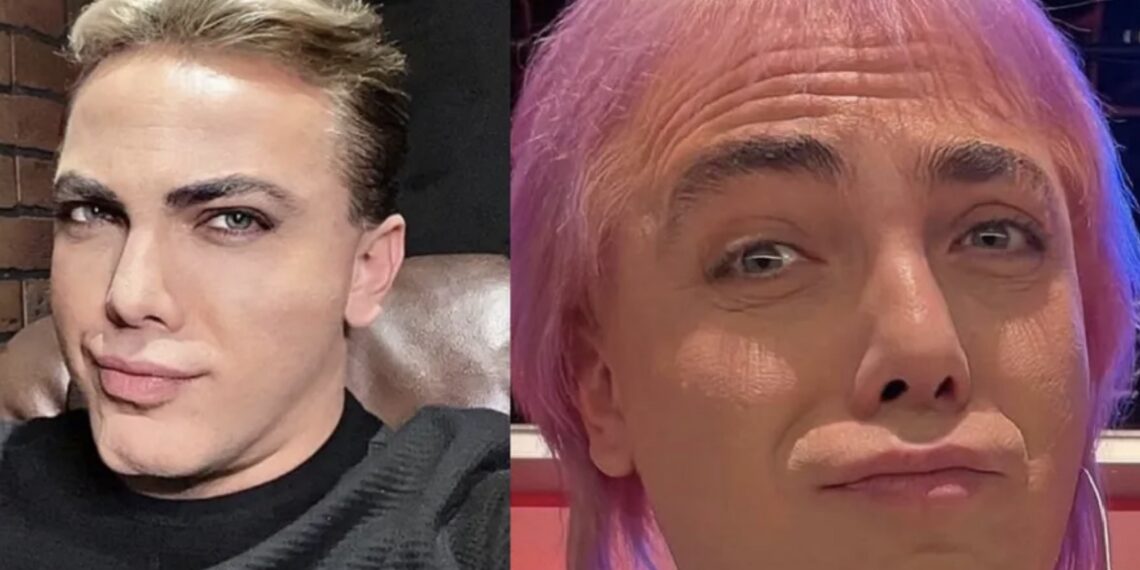 En entrevistas ha hablado con acento argentino, por lo que muchos mexicanos se han preguntado y han criticado que el cantante haya decidido hablar así.