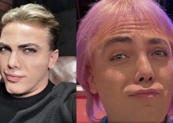 En entrevistas ha hablado con acento argentino, por lo que muchos mexicanos se han preguntado y han criticado que el cantante haya decidido hablar así.