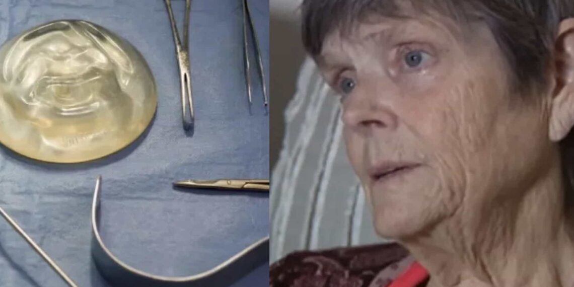 La mujer mayor agregó que también tuvo un ‘levantamiento de glúteos brasileño’ que tampoco pidió.