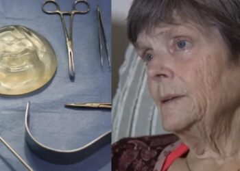 La mujer mayor agregó que también tuvo un ‘levantamiento de glúteos brasileño’ que tampoco pidió.