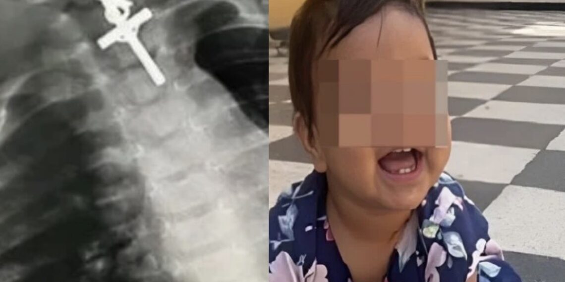 En la cirugía participaron anestesiólogos y gastroenterólogos; tuvo una duración aproximada de seis horas.