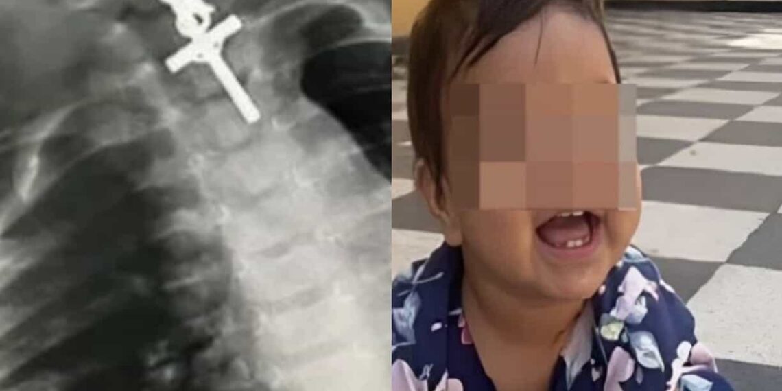 En la cirugía participaron anestesiólogos y gastroenterólogos; tuvo una duración aproximada de seis horas.