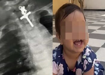 En la cirugía participaron anestesiólogos y gastroenterólogos; tuvo una duración aproximada de seis horas.