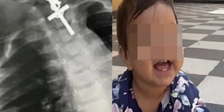 En la cirugía participaron anestesiólogos y gastroenterólogos; tuvo una duración aproximada de seis horas.