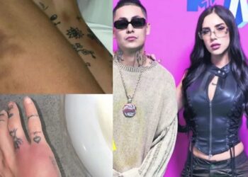 Akasha publicó en sus redes sociales imágenes de los golpes que recibió al parecer del rapero mexicano Alemán.