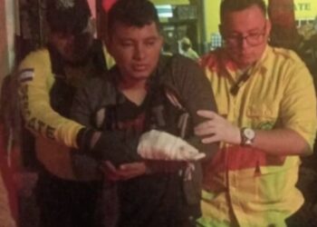 Un terrible accidente sufrió un hombre que jugaba con cohetes; uno llamado 'mortero' le estalló en la mano y perdió todos sus dedos