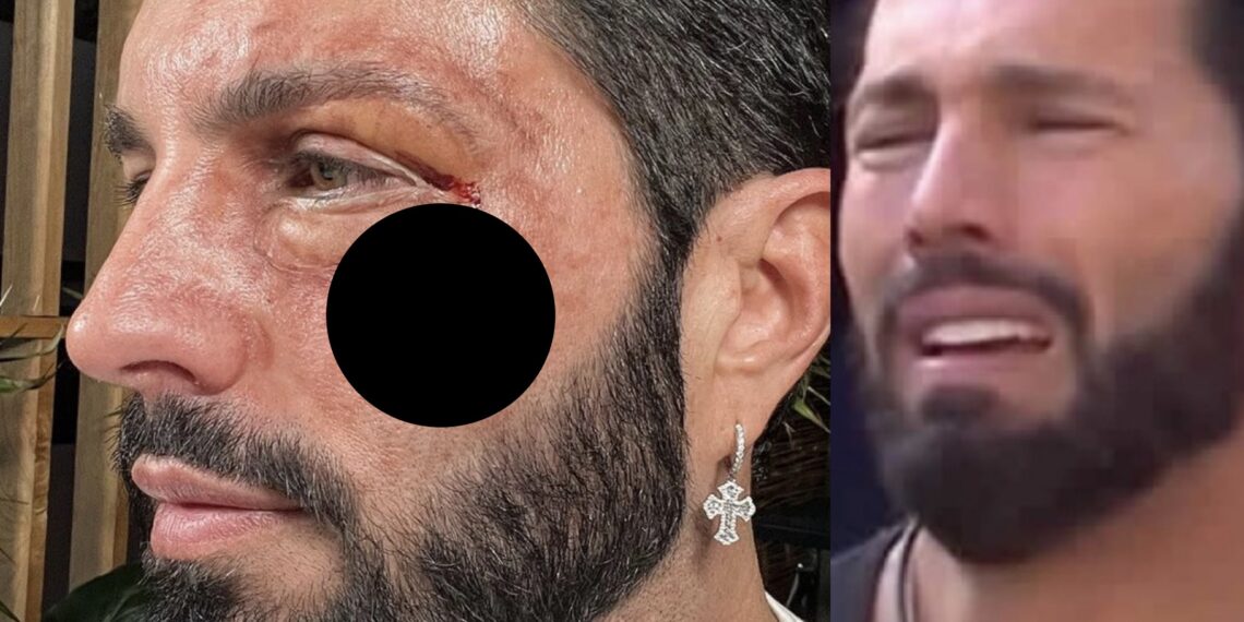 El exparticipante de "La Casa de los Famosos" señaló a los posibles responsables de la golpiza que recibió