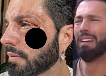 El exparticipante de "La Casa de los Famosos" señaló a los posibles responsables de la golpiza que recibió
