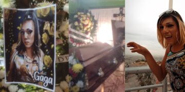 La Gaga fue hospitalizada en varias ocasiones; al parecer, una bacteria en sus intestinos le provocó complicaciones.