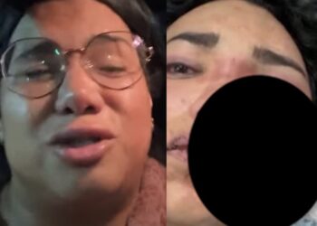 Después de que la integrante de "Las Perdidas" fuera golpeada por su prometido, sus amigas se unieron para apoyarla
