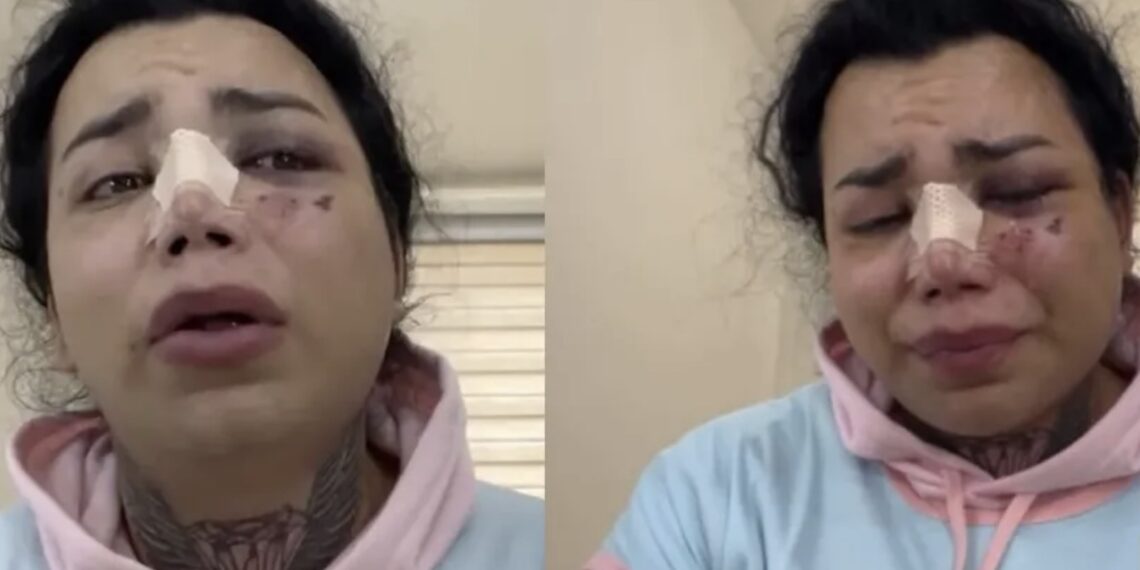 Paola Suárez fue atacada por Jesús, quien era su novio, las lesiones la llevaron a pasar dos días en el Hospital General de León