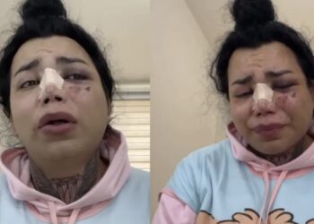 Paola Suárez fue atacada por Jesús, quien era su novio, las lesiones la llevaron a pasar dos días en el Hospital General de León