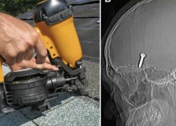 Los hechos ocurrieron en el Hospital Sultanah Bahiyah de Alor Setar, en la costa occidental de Malasia