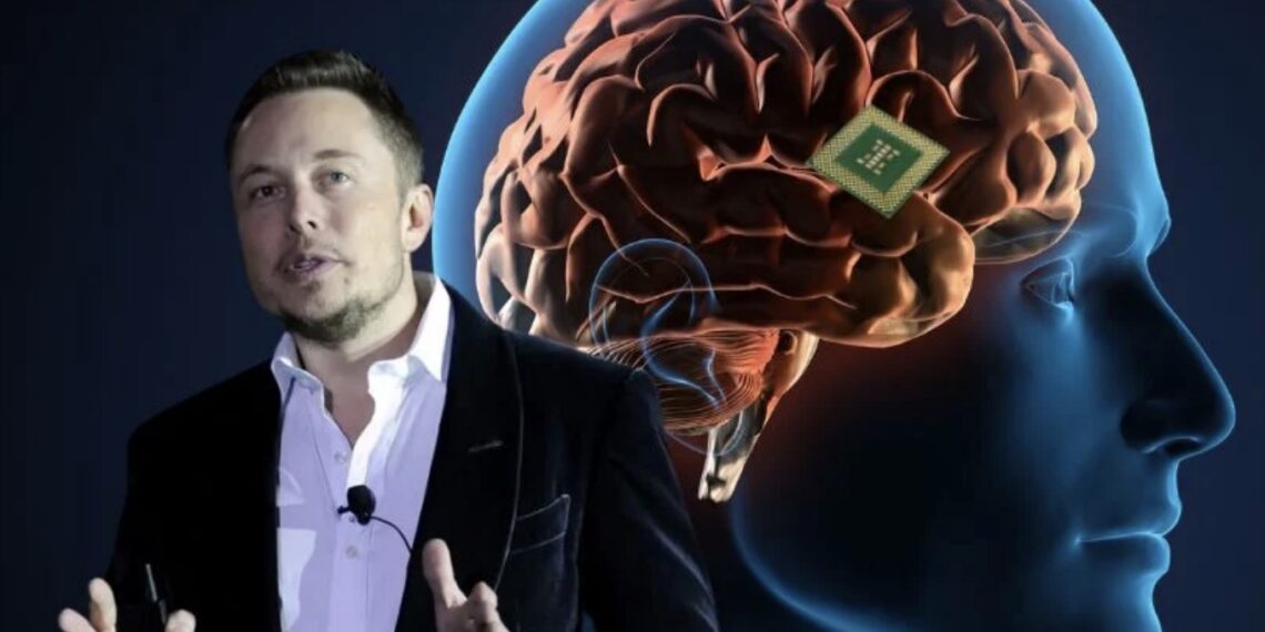 Neuralink quiere conectar cerebros humanos a computadores y ayudar a tratar afecciones neurológicas.