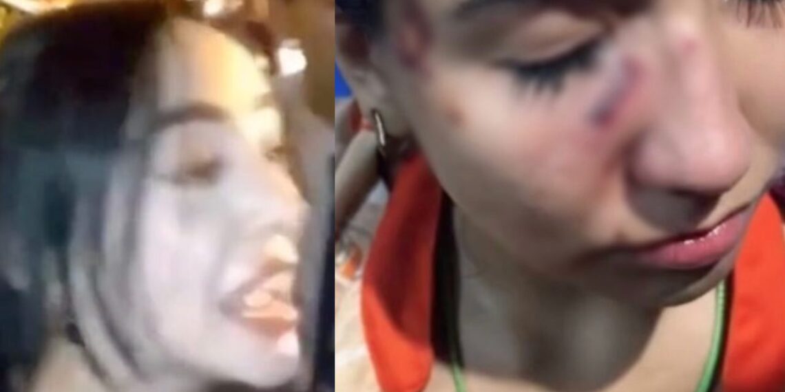 La joven relató que fue llevada a emergencias tras recibir un golpe en el ojo por el que tuvo que recibir cinco puntadas