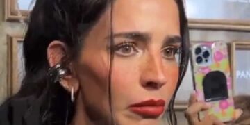La influencer se sinceró con sus seguidores y compartió una imagen de la impactante herida.