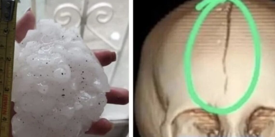 La menor se encuentra internada en un hospital de Monterrey, Nuevo León; había salido a cubrir los autos para evitar que se dañaran