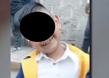 La madre de familia pide apoyo para cubrir los gastos ya que el menor requiere otra cirugía.