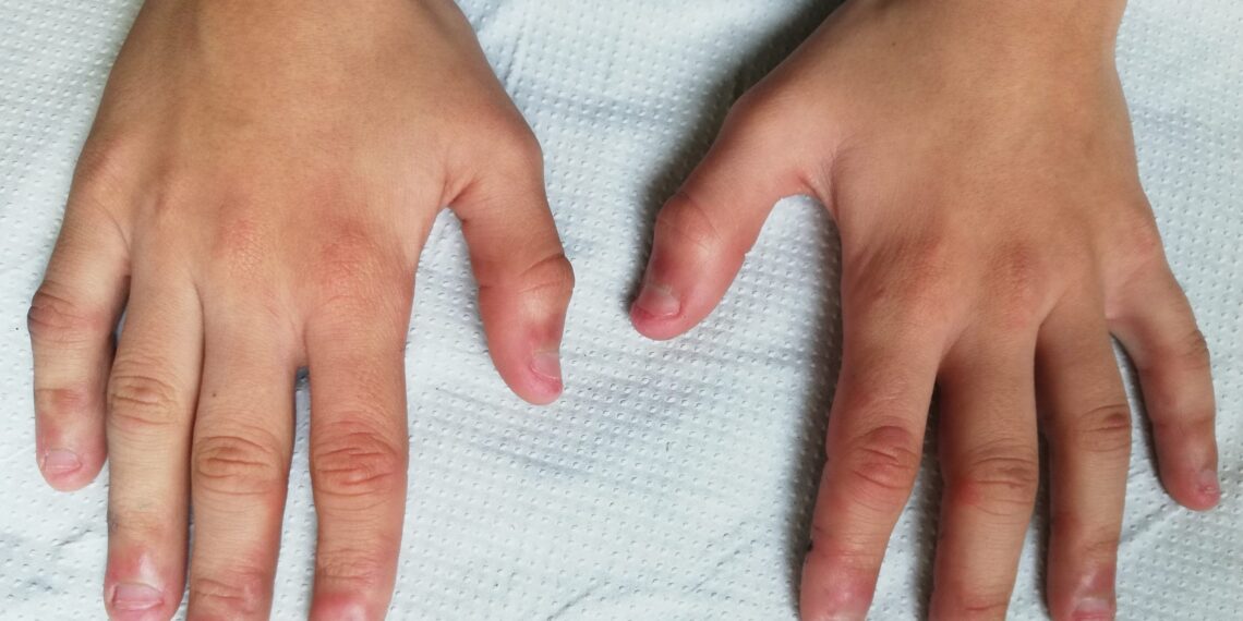 Tras ser abusada por un familiar, la menor quedó embarazada, tiempo después sufrió un aborto, por lo que ahora la Fiscalía de Querétaro busca sentenciarla a tres años de prisión.