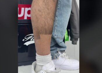 La tendencia consiste en dejar crecer el vello de las piernas y luego recortarlo o teñirlo