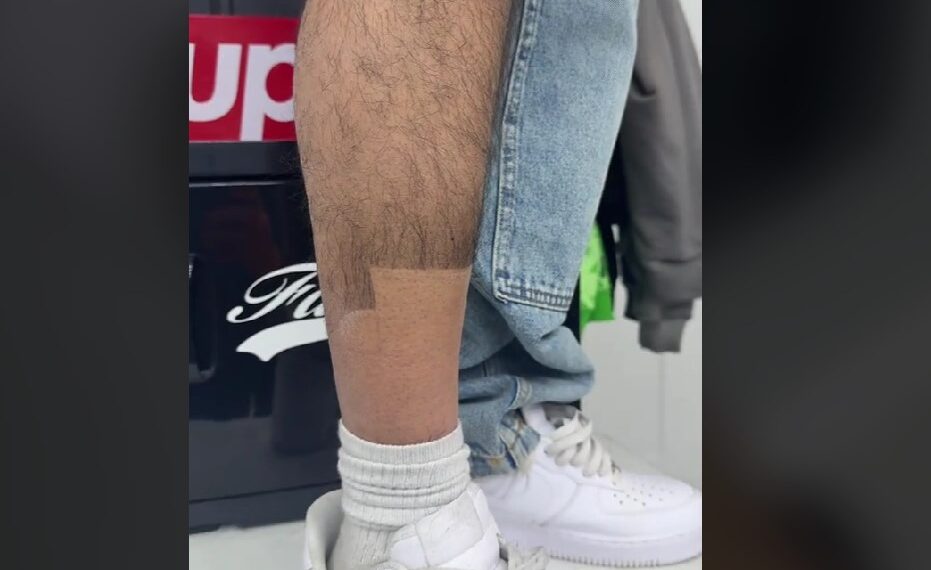 La tendencia consiste en dejar crecer el vello de las piernas y luego recortarlo o teñirlo