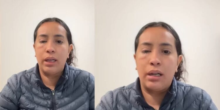 Mujer le arroja ácido a vendedora de fresas con crema en Tijuana