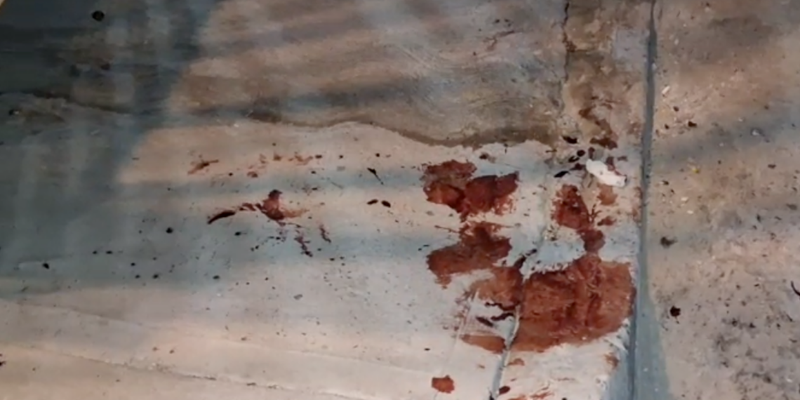 Chofer de plataforma resulta herido con arm. blanca tras as.lto en la colonia Anáhuac