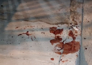 Chofer de plataforma resulta herido con arm. blanca tras as.lto en la colonia Anáhuac