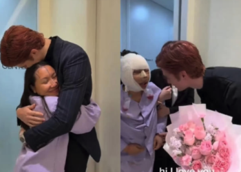 se somete a cirugía facial tras críticas en redes que comparaban su apariencia con la de su esposo