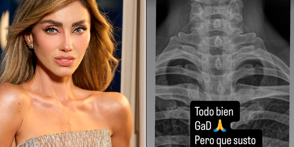 Anahí sufre aparatosa caída durante rutina de pilates y alarma a sus seguidores