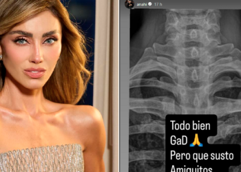 Anahí sufre aparatosa caída durante rutina de pilates y alarma a sus seguidores