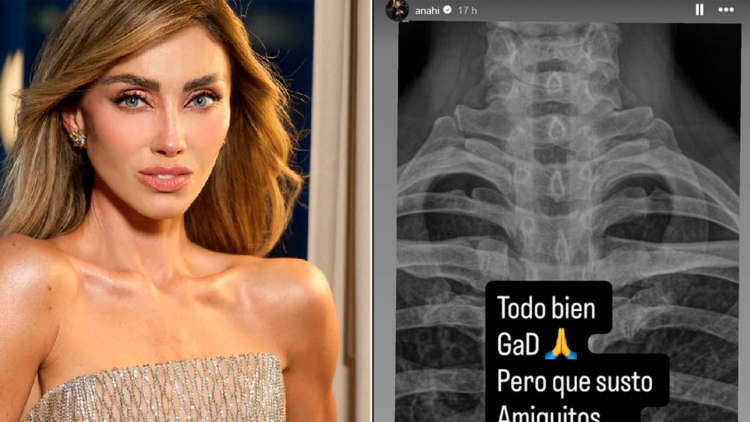 Anahí sufre aparatosa caída durante rutina de pilates y alarma a sus seguidores